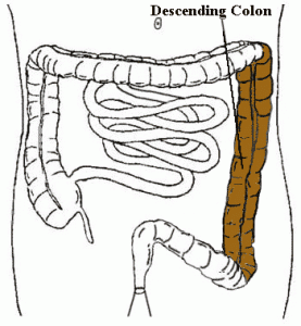 Picture of Descending colon