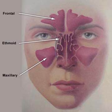 Picture of Frontal sinus
