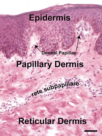 Picture of Papillary dermis