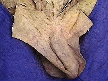 pictures of modified male penis
