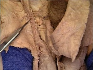Picture of Cremaster muscle