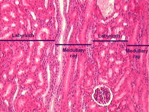 Image of Medullary Ray