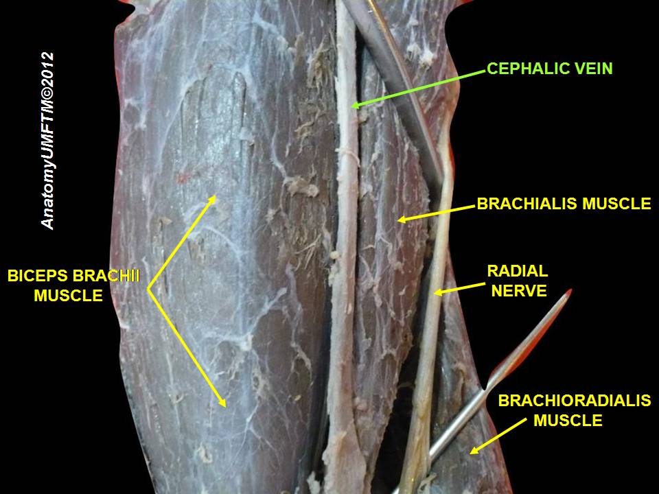 Cephalic vein Image