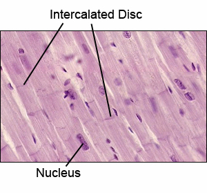 Picture of Intercalated discs