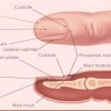 Picture of Nail Matrix