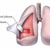 Image of Parietal pleura