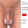 Picture of External urethral orifice in males