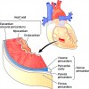 Image of Serous pericardium