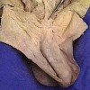 Picture of Fundiform ligament of Penis