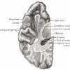 Picture of Transverse temporal gyrus