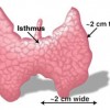 Image of Thyroid isthmus