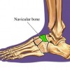 Picture of Navicular Bone