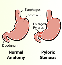Image of Pulmonary Ligament