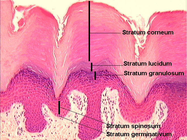 皮肤棘细胞层图片