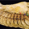 Image of Thoracic splanchnic nerves