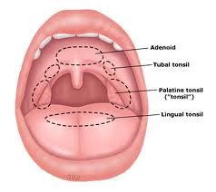 Image of Tubal tonsil