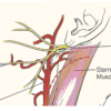 Sternocleidomastoid muscle location