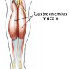 Image of Gastrocnemius