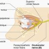 Picture of Oculomotor Nerve