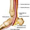 Picture of Tibialis Posterior