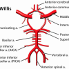 Picture of Circle of Willis